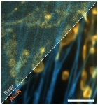 Fast, Accurate Scientific CMOS Noise Correction Advances Imaging for Fluorescence Microscopy Fast, Accurate Scientific CMOS Noise Correction Advances Imaging for Fluorescence Microscopy