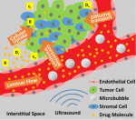Buzzing Cancer Drugs into Malignancies in the Brain Buzzing Cancer Drugs into Malignancies in the Brain