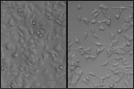 Study shows how breast cancer cells break free to spread in the body Study shows how breast cancer cells break free to spread in the body
