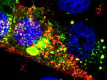 Biomedical Imaging and Optics Biomedical Imaging and Optics