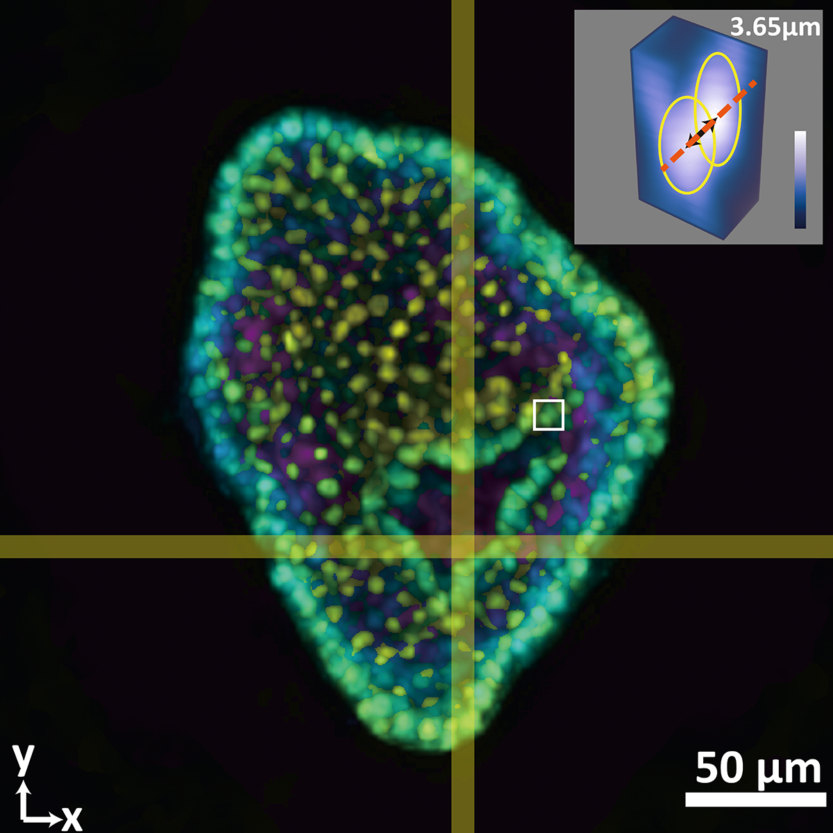 This composite image shows a colon organoid with stained cell nuclei reconstructed from a raw image taken by a new system developed in the Coulter Department. The large image shows depth color coded from yellow (-56.2 micrometers from the focal plane) to purple (+56.2 micrometers from the focal plane). The inset shows a tight crop of the distance between two cells of 3.65 micrometers. The single raw image was captured in 0.1 seconds. (Image Courtesy: Shu Jia & Wenhao Liu)