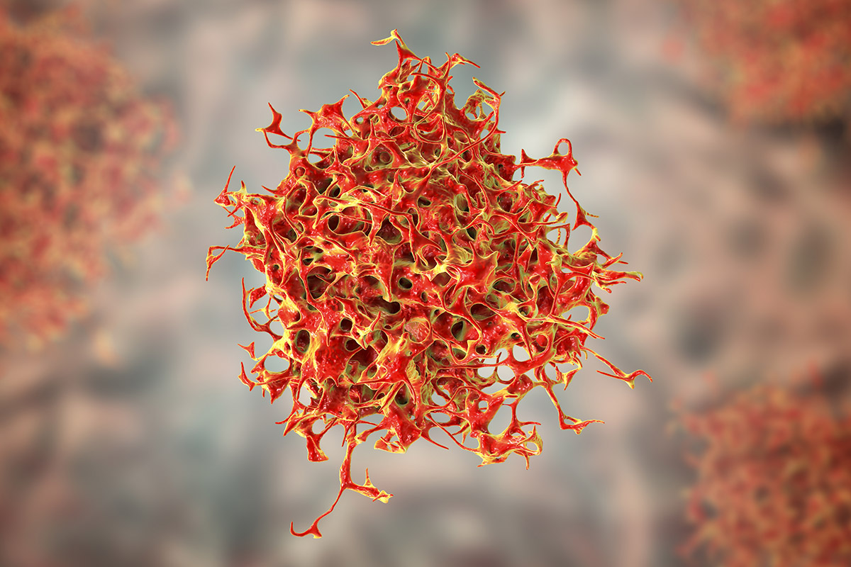 Cancer cell Cancer cell