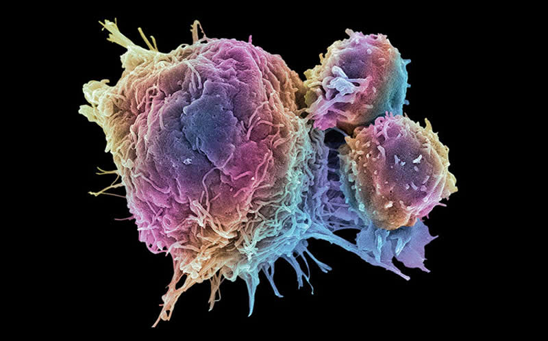 Cancer Technologies Cancer Technologies