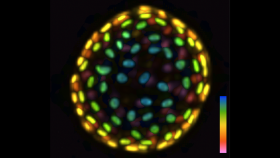 An image of a colon organoid captured by a new system developed in Shu Jia’s lab that can capture dynamic, 3D information about the lab-grown cultures of tissues in a single image. The raw image was captured in 0.1 seconds. The coloration represents depths of 60 and -60 micrometers from the focal plan to depict the organoid in three dimensions. (Image Courtesy: Shu Jia & Wenhao Liu)