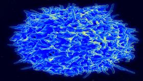 A healthy human T cell. Credit: National Institute of Allergy and Infectious Disease / National Institutes of Health