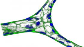 A miniature blood vessel, formed on agarose/gelatin hydrogel. Green represents VE-cadherin, a protein that glues cells together, and blue is nuclei.

Courtesy of Yongzhi Qiu.