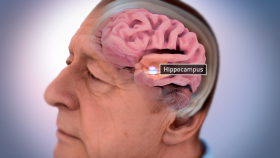 The brain of an Alzheimer's sufferer can dramatically lose mass and shrink. In particular, center structures of the brain usually diminish early on. One such region susceptible to early and severe damage is the hippocampus, which can lead to memory loss and disorientation. Illustration credit: National Institute on Aging, National Institutes of Health