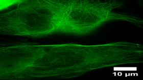 This super-resolution fluorescence microscopy image of HyPer-Tau shows the microtubular structure of a human (HeLa) cancer cell. The image was made using the new super-resolution microscope in the Georgia Tech Institute for Bioengineering &amp; Bioscience (IBB). (Credit: Emilie Warren, Georgia Tech) 