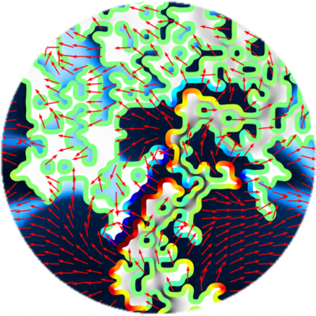 Mathematical modeling quantifies increased movement of drug molecules and of interstitial fluids that bathe cells and can circulate drug molecules that have crossed out of the bloodstream and into brain tissue spaces. Credit: Massachusetts General Hospital / Georgia Tech / Arvanitis / Askoxylakis