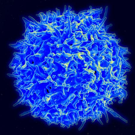 A healthy human T cell. Credit: National Institute of Allergy and Infectious Disease / National Institutes of Health