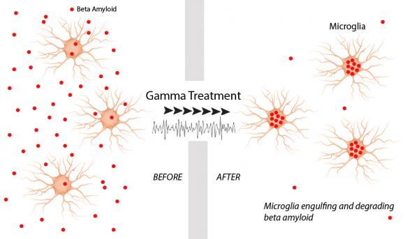 Gamma oscillation brain waves suppressed beta amyloid production and invigorated microglia