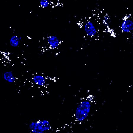 CpG-loaded polymer carriers trigger robust toll-like receptor 9 signaling in dendritic cells. (Image courtesy Jardin Leleux, Georgia Tech)