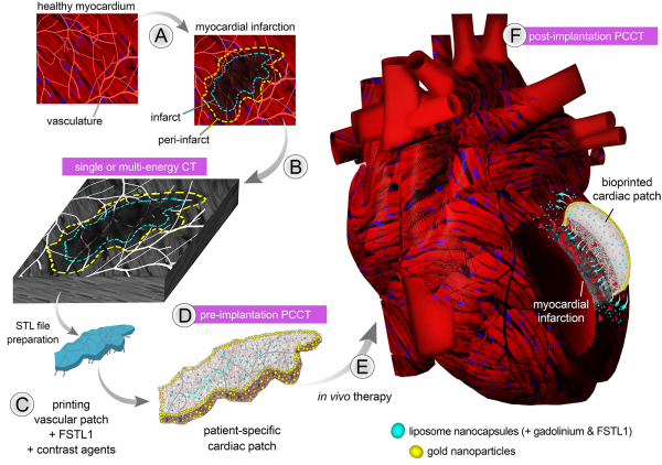 Graphical summary of Vahid Serpooshan's project.