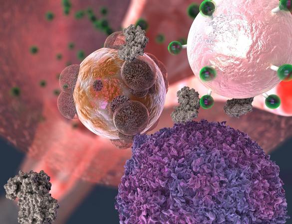 A T cell, here in purple, makes contact with a transplant organ cell, here in reddish brown. The T cell secretes the enzyme granzyme B, here in gray, which attacks the organ cell. But granzyme B also severs fluorescent signal molecules, in green, from the rejection detecting nanoparticle, in light pink. The signal molecules make their way into the urine, where they give off a fluorescent cue. Georgia Tech / EllaMaru Studio (work for hire, all rights GT, free for distribution).