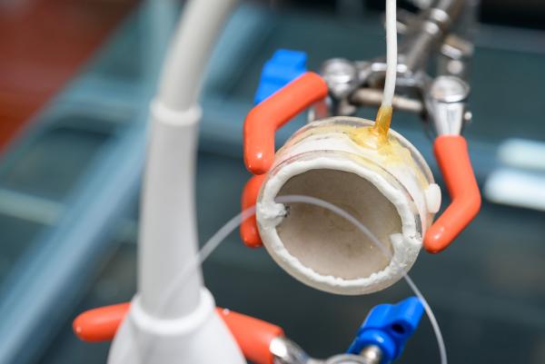 The parabolic shape helps researchers focus ultrasound energies to concentrate them on an area. This is a set-up in Costas Arvanitis's Georgia Tech lab to test the device and not part of a treatment or experiment. Credit: Georgia Tech / Rob Felt