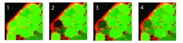 A sequence of images depicts the photo bleaching (frame 2) and recovery (frames 3-4) of a fluorescent dye for quantification of relative diffusion rates between adjacent stem cells within a colony. (Credit: Chad Glen, Georgia Tech)