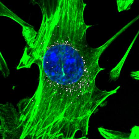 Cells, stained in green with blue nuclei, are targeted by nanoparticles carrying DNA barcodes (white). The nanoparticles efficiently delivery their DNA payload into the cells. (Image courtesy of Daryll A. Vanover, Kalina Paunovska, and Cory Sago at Georgia Tech).