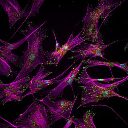 Image shows adult human fibroblast cells with intracellular proteins involved in adhesion of these cells to an extracellular matrix. Magenta represents actin stress fibers in a cell and green staining represents a focal adhesion protein vinculin, which together contribute to how strongly these cells adhere to a matrix surface. Blue is the nucleus of a cell. These fibroblasts are converted to human induced pluripotent stem cells through a reprogramming process during which restructuring of the adhesion prote