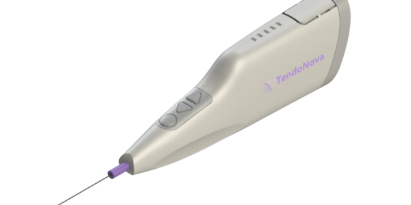 TendoNova™’s lead device, the Ocelot™ is used under ultrasound guidance to treat chronic tendon pain