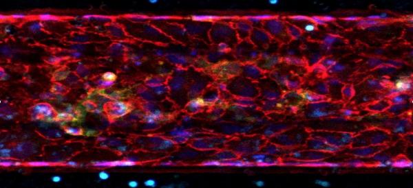 Endothelial cells seen in a microvessel mimicking chip. Researchers will develop a similar artery-on-a-chip, which researchers in Tony Kim's lab at Georgia Tech will use to study the effects of engineered HDL and inflammatory protein in atherosclerosis. They hope to gain insights into which "good cholesterol" treatments have failed in atherosclerosis, and will look for HDL cocktails that are more effective. Credit: Georgia Tech / Tony Kim lab