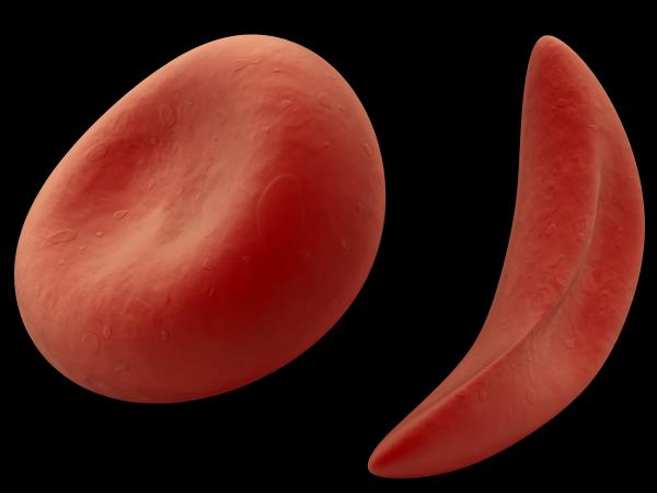 Georgia Tech hosts the Sickle Cell Disease Symposium to discuss research and efforts in combatting this complex and debilitating blood disorder.Credit: BigStockPhoto