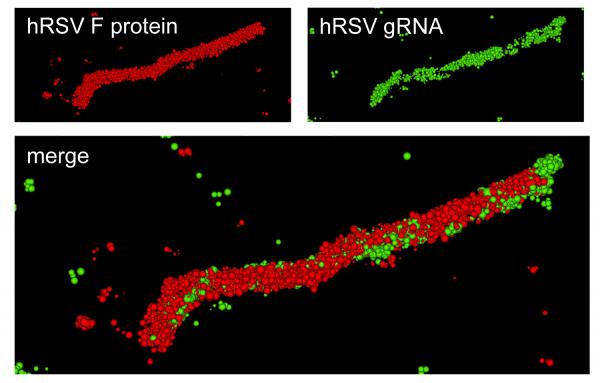 A super-resolution optical image of a specific hRSV viral filament produced with dSTORM technology. The viral filament is approximately 4 microns in length, typical of hRSV. (Image courtesy of Eric Alonas and Philip Santangelo)