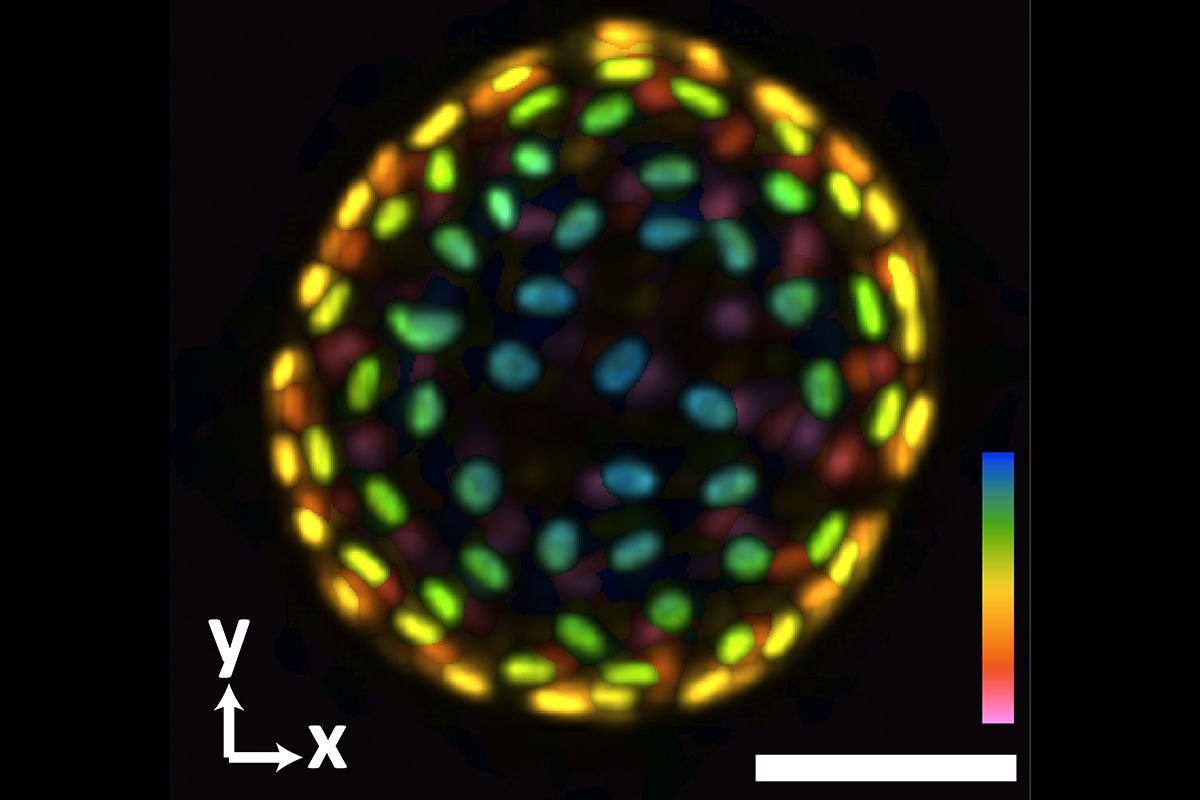 An image of a colon organoid captured by a new system developed in Shu Jia’s lab that can capture dynamic, 3D information about the lab-grown cultures of tissues in a single image. The raw image was captured in 0.1 seconds. The coloration represents depths of 60 and -60 micrometers from the focal plan to depict the organoid in three dimensions. (Image Courtesy: Shu Jia & Wenhao Liu)
