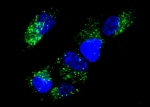 Scientists Demonstrate Basics of Nucleic Acid Computing Inside Cells Scientists Demonstrate Basics of Nucleic Acid Computing Inside Cells