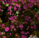 Organoids Predict Immune Response in Aged and Young Individuals against Antibiotic-resistant Bacteria Organoids Predict Immune Response in Aged and Young Individuals against Antibiotic-resistant Bacteria