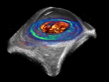 Biomedical Imaging and Instrumentation Biomedical Imaging and Instrumentation