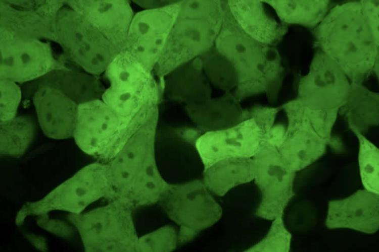 Dahlman Lab for Precision Therapies @GeorgiaTech Dahlman Lab for Precision Therapies @GeorgiaTech