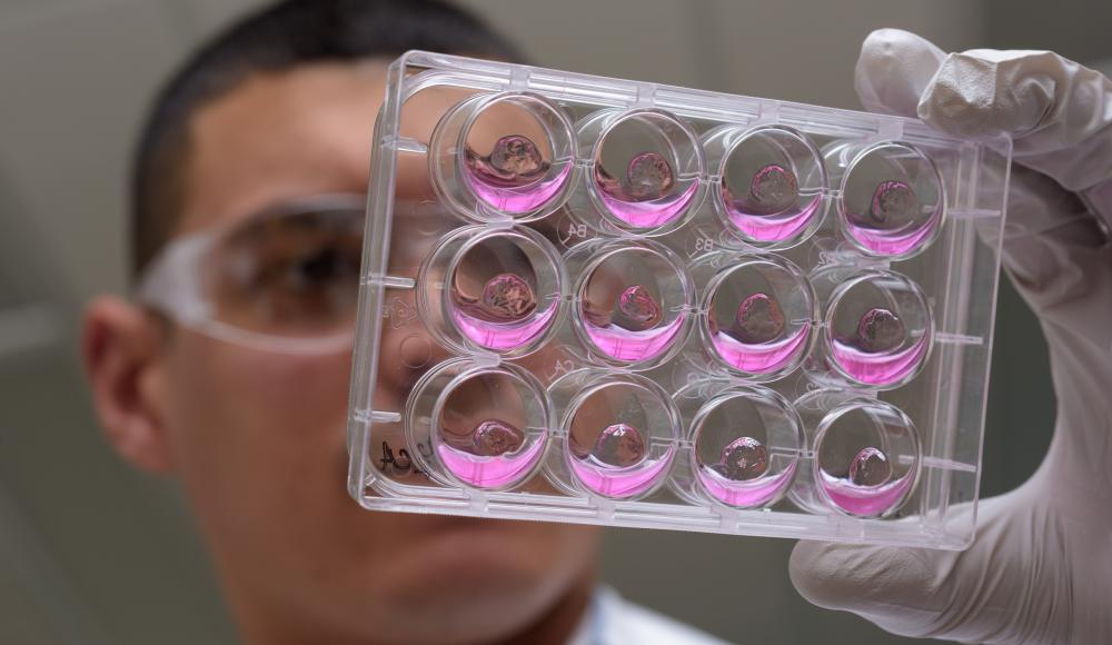 Photo of student researcher holding up a cell sample